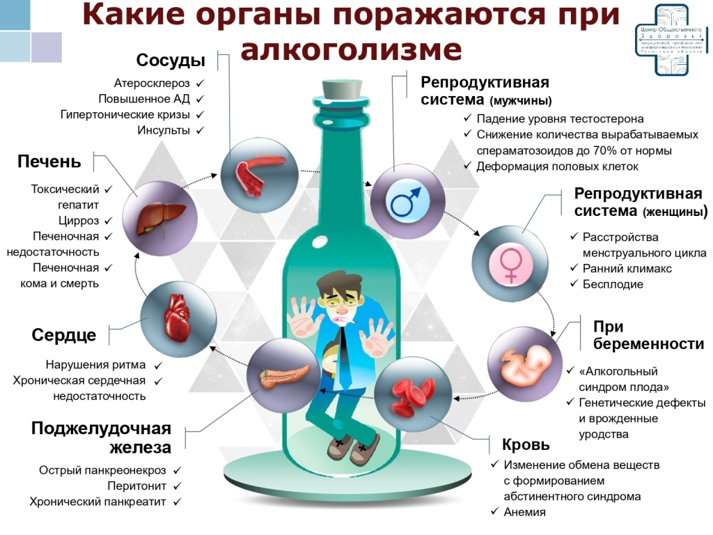 От питья нет житья | 12.09.2023 | Сыктывкар - БезФормата